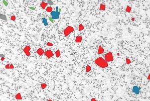 PSA300 - Static Image Analysis System Particle Size